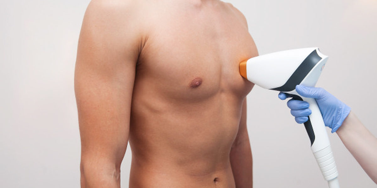 Epilazione Laser uomo, torace addome, Catania, Giarre, Provincia di Catania