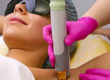 Centro Epilazione Laser ascelle inguine gambe a Catania