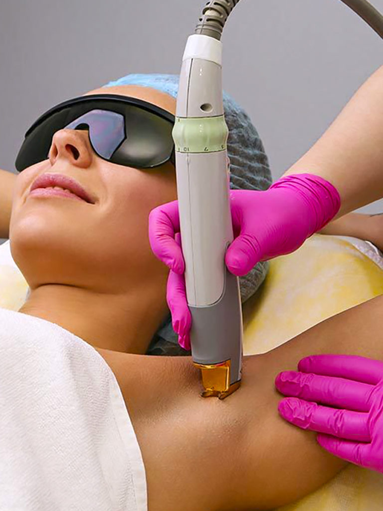 Centro Epilazione Laser ascelle inguine gambe a Catania