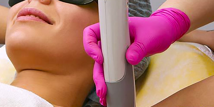 Centro Epilazione Laser ascelle inguine gambe a Catania