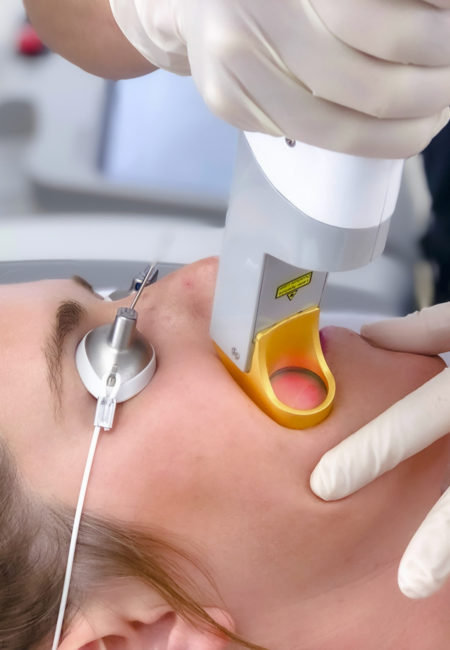 Epilwow Epilazione Lase medicale