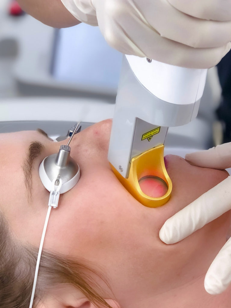 Epilwow_Epilazione_Laser_medicale Epilwow Epilazione Lase medicale