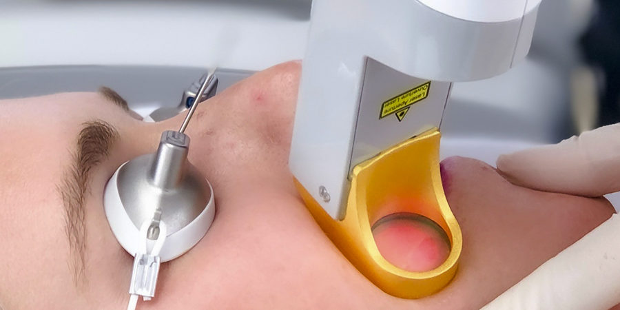 Epilwow_Epilazione_Laser_medicale Epilwow Epilazione Lase medicale