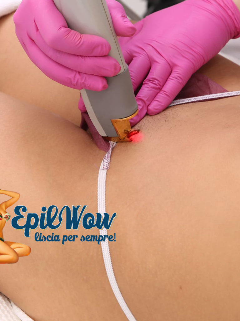 Epilazione inguine con laser a Catania
